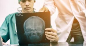 Brain Injury