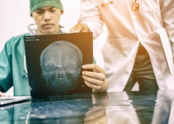 concussion litigation