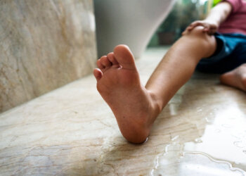 What do when in a Slip and Fall Accident in Dallas