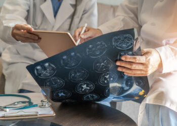 Infant Traumatic Brain Injuries: Assessing a Child’s Lost Future Earning