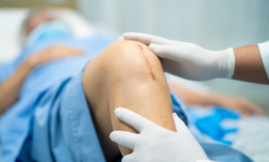total knee replacement-lawsuits