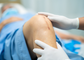 total knee replacement-lawsuits