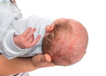 Pursuing Birth Trauma Compensation in Texas