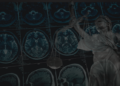 What Becoming a Brain Tumor Patient Taught Me About Advocacy