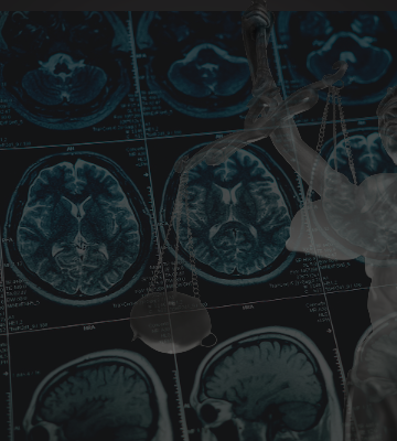 What Becoming a Brain Tumor Patient Taught Me About Advocacy